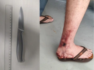 Homem é esfaqueado pela esposa durante briga em Toledo