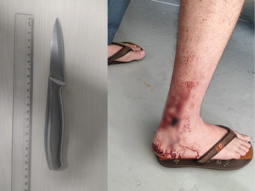 Homem é esfaqueado pela esposa durante briga em Toledo