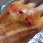 Idosa fica ferida ao ser atacada por cachorro em Quatro Pontes
